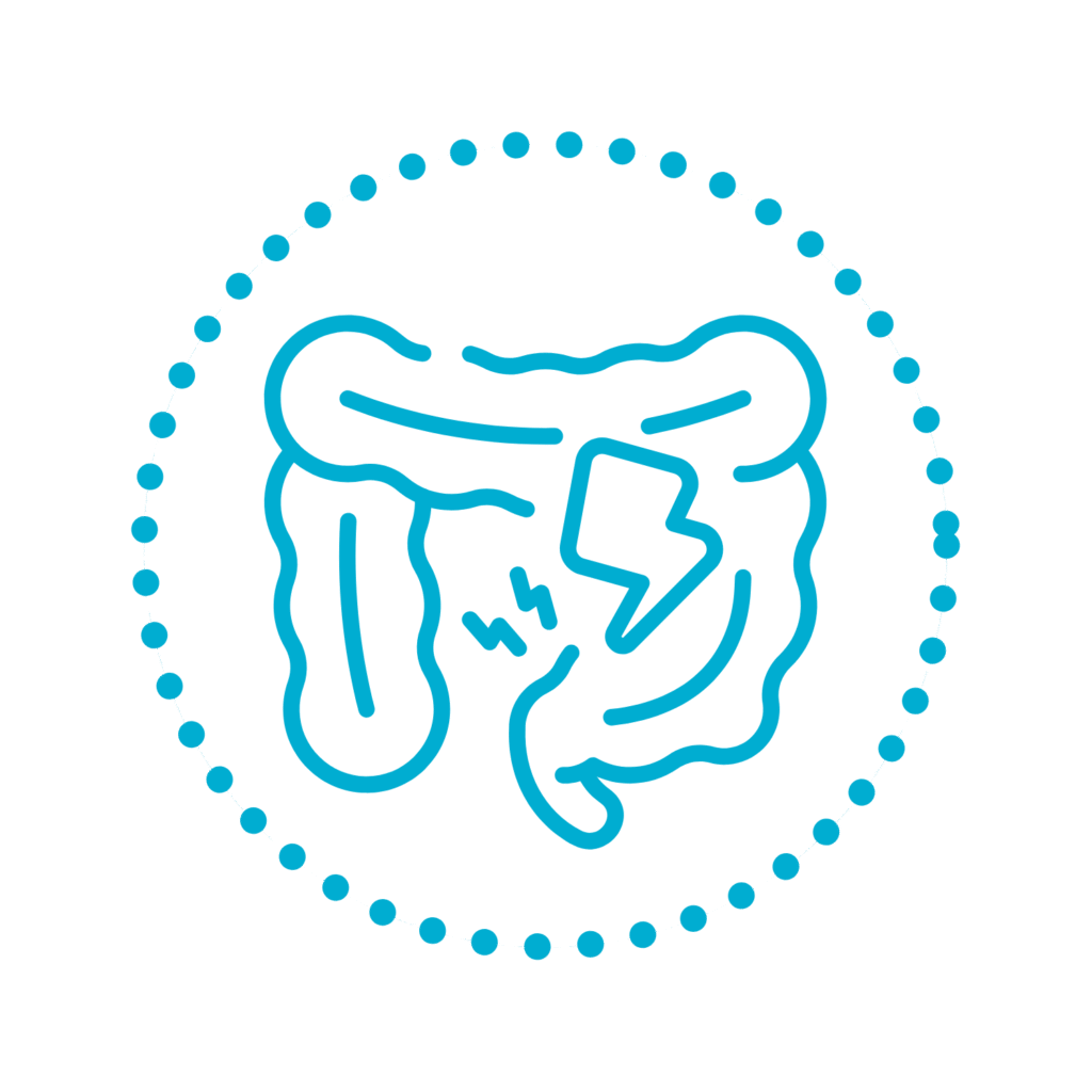 Ulcerozni kolitis (UC)