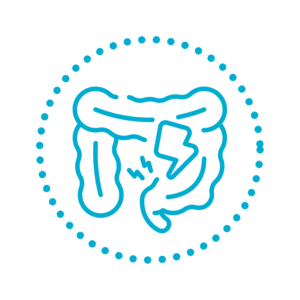 Ulcerozni kolitis (UC)