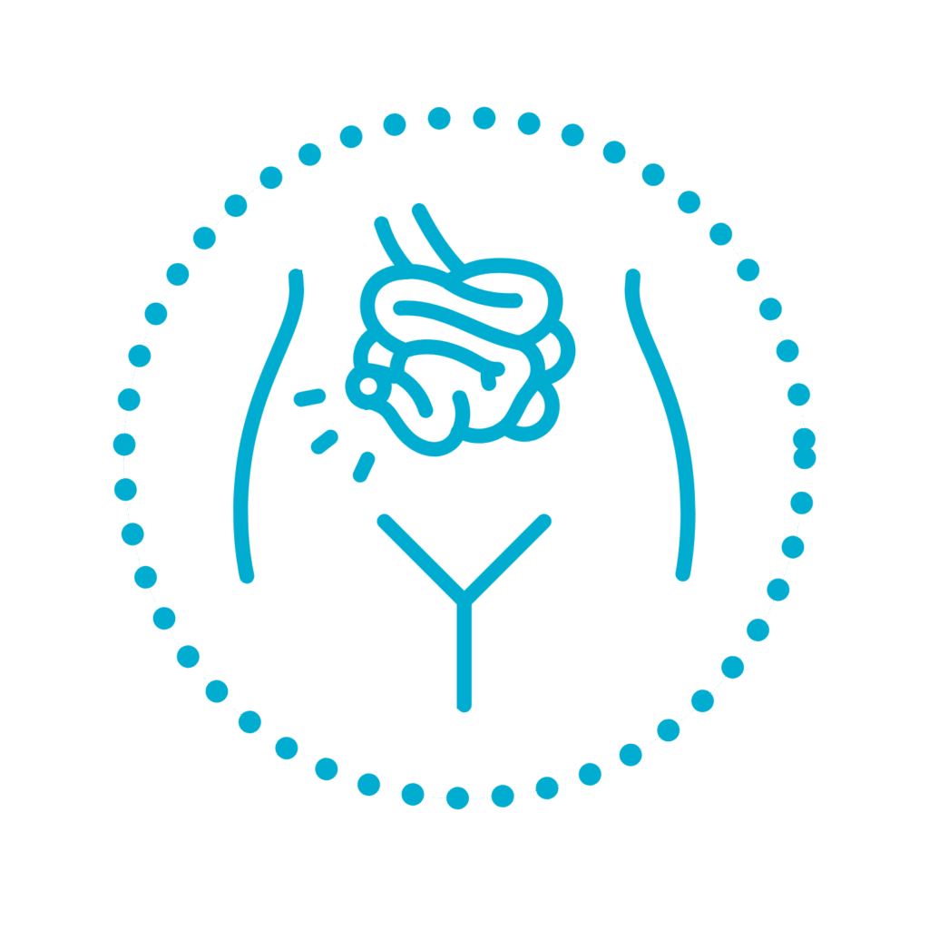 Pouchitis (upala ilealne vrećice)