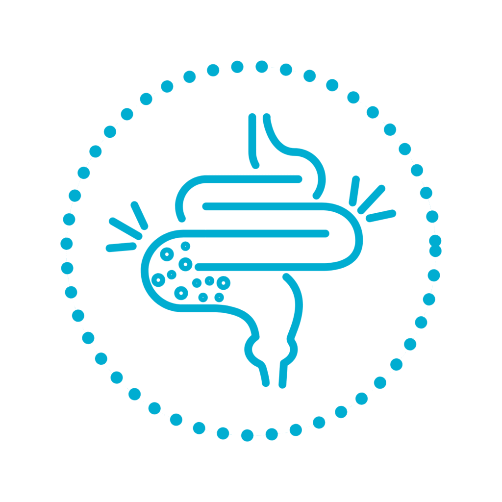 Sindrom iritabilnog crijeva (IBS)