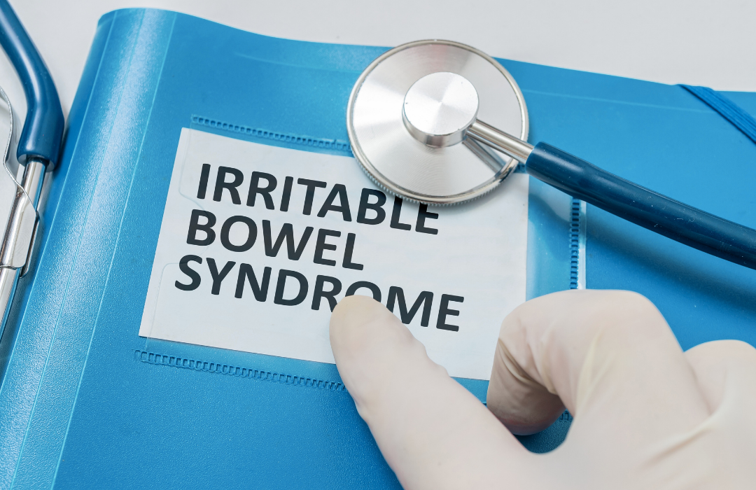 Sindrom-iritabilnog-crijeva